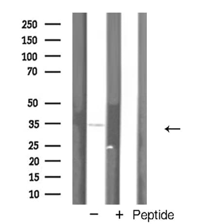 Polyclonal Rabbit anti-Human AQP12A / Aquaporin 12A Antibody (WB)
