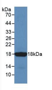 SST / Somatostatin Antibody