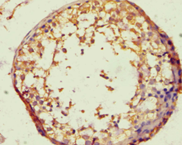 Polyclonal Rabbit anti-Human BACH1 Antibody (aa1-320, IHC)