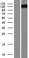 DAB2IP Protein (Over-Expression Lysate Myc-DDK (Flag))