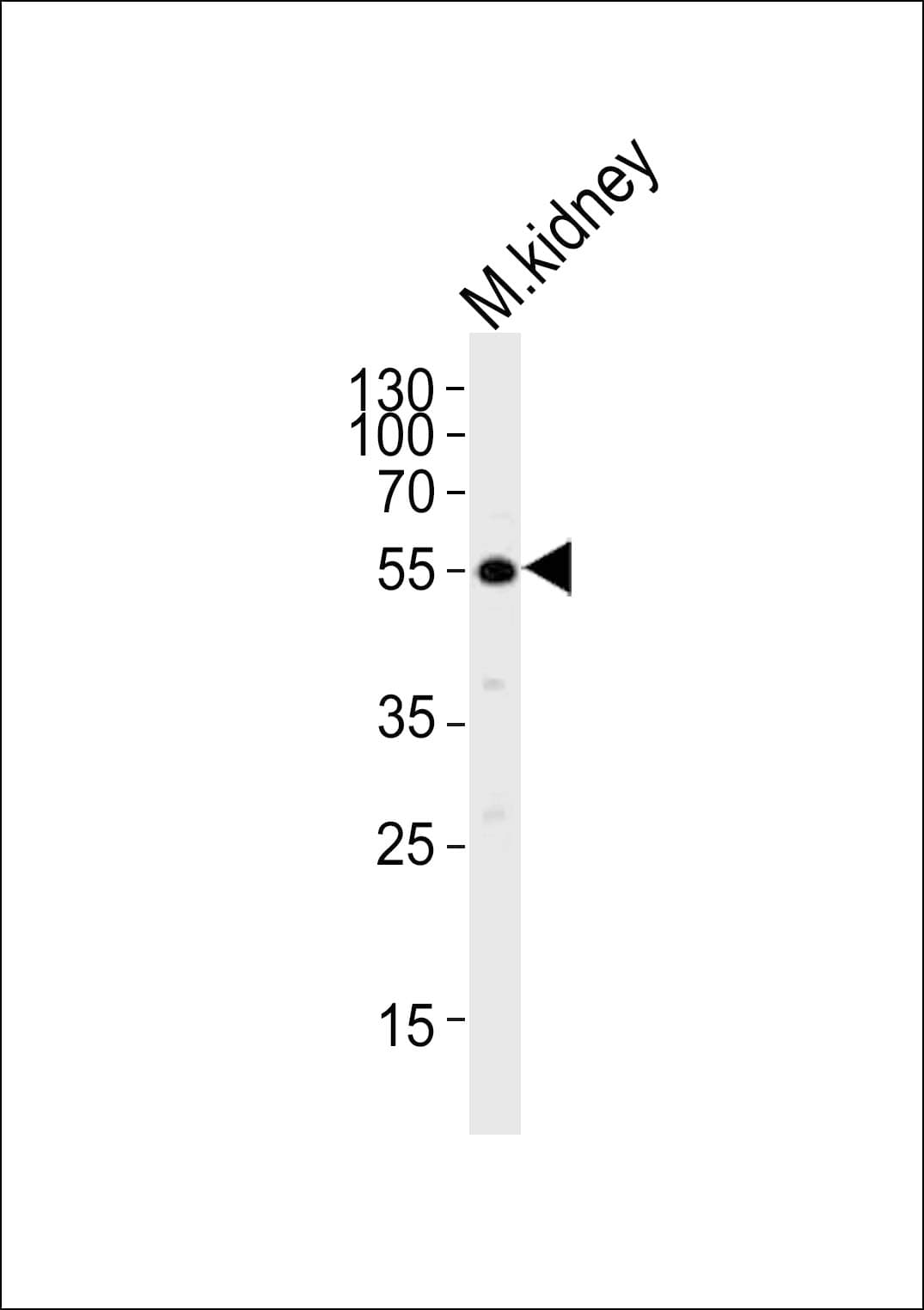 IHC-plus™ NACC1 / NAC1 Antibody (aa324-358)