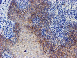 ERBB2 / HER2 Antibody (aa676-1255, clone OTI11A7, Carrier-free)