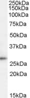 IHC-plus™ D52 / TPD52 Antibody (aa213-223)