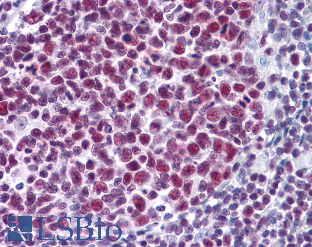 IHC-plus™ SNRPA / U1A Antibody (clone 3F9-1F7)