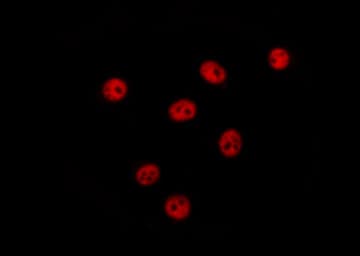 NAB2 Antibody