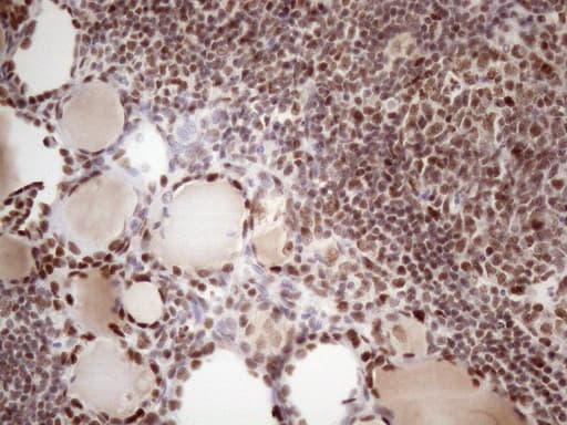 TP53BP1 / 53BP1 Antibody (aa1-300, clone OTI2H6)