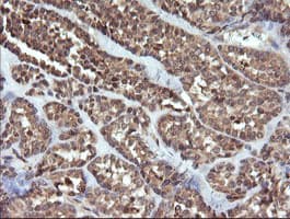 Monoclonal Mouse anti-Human UBE2G2 Antibody (clone OTI1D2, IHC, IF, WB)