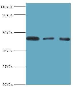 CALR3 Antibody (aa135-384)