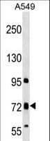 TMC4 Antibody (aa68-94)