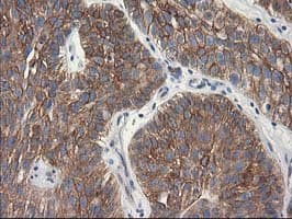 TUBB4 / Tubulin Beta 4 Antibody (clone 3C12, Carrier-free)