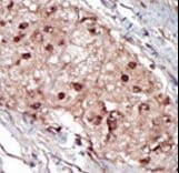 SPHK / SPHK1 Antibody (aa286-315)