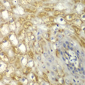 Polyclonal Rabbit anti-Human MYO1C Antibody (IHC, IF, WB)
