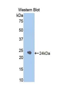 SERPINA6 / CBG Antibody (aa173-344)