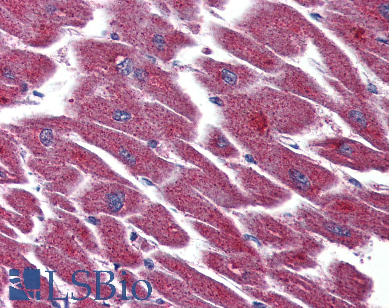 IHC-plus™ Polyclonal Rabbit anti-Human LPAR3 / LPA3 / EDG7 Antibody (Internal, IHC)