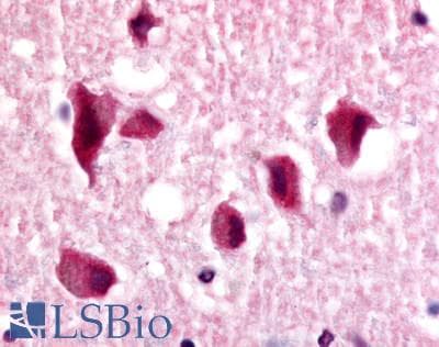 PathPlus™ NR2E1 / TLX Antibody (N-Terminus)