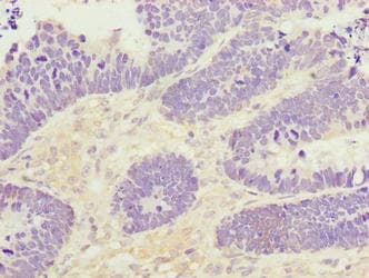 PADI3 Antibody