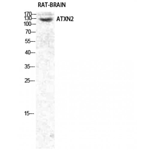 ATXN2 / SCA2 / Ataxin-2 Antibody (700-780 aa, Internal)