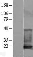 Human CFL1 / Cofilin Protein (Over-Expression Lysate Myc-DDK (Flag))