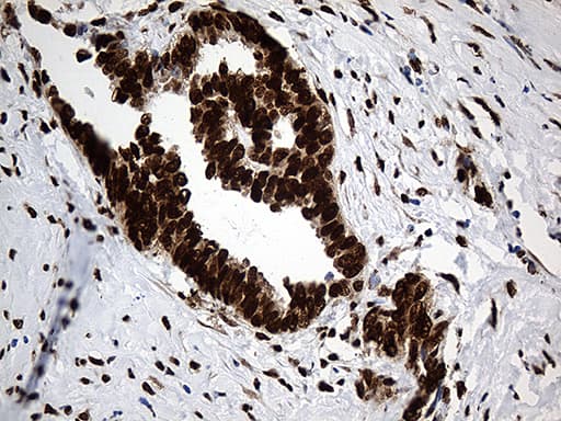 Monoclonal Mouse anti-Human PTBP3 / ROD1 Antibody (clone OTI5G7, aa300-552, IHC, WB)