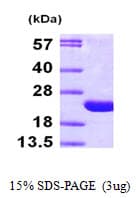 Human ARF6 Protein (Recombinant His)