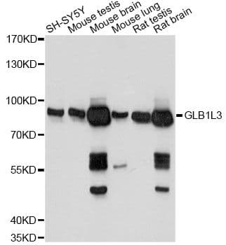 GLB1L3 Antibody