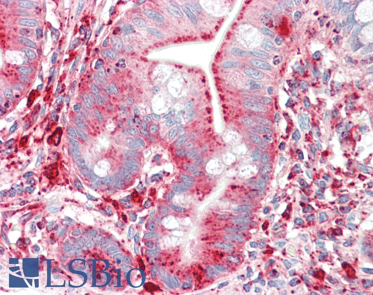 IHC-plus™ Monoclonal Mouse anti-Human LAMP1 / CD107a Antibody (clone 5H6, aa32-350, IHC, IF, WB)