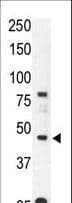 ACKR2 / CCR10 / D6 Antibody (aa54-84)