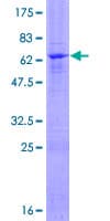 Human ZFP1 Protein (Recombinant GST)