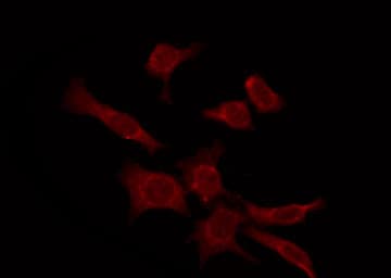 Polyclonal Rabbit anti-Human OPN4 / Melanopsin Antibody (IF, WB)