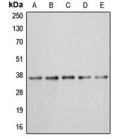 Polyclonal Rabbit anti-Human ANXA3 / Annexin A3 Antibody (Internal, IHC, WB)