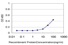 HIPK1 Antibody (clone 4C2)