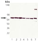 HSPA8 / HSC70 Antibody