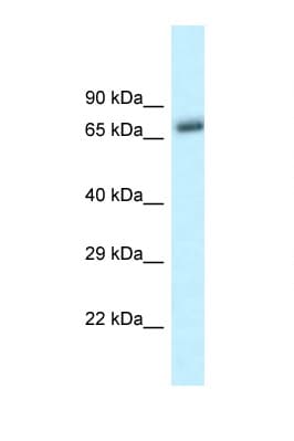 BTRCP / BETA-TRCP Antibody (C-Terminus)
