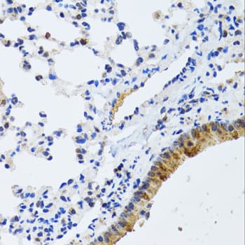Polyclonal Rabbit anti-Human MMP19 Antibody (IHC, WB)