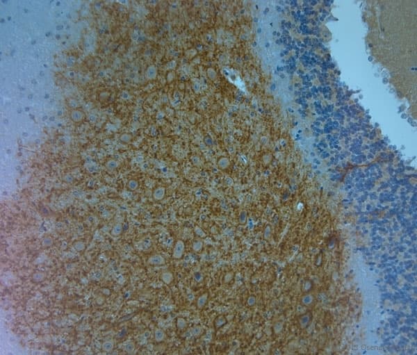 Polyclonal Rabbit anti-Human ACAN / Aggrecan Antibody (aa200-250, IHC)
