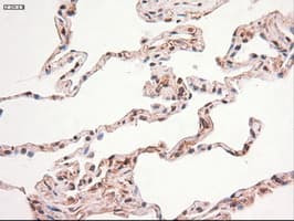 MYC / c-Myc Antibody (clone OTI5G3)