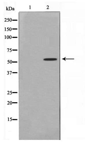 Polyclonal Rabbit anti-Human TTC23 Antibody (WB)
