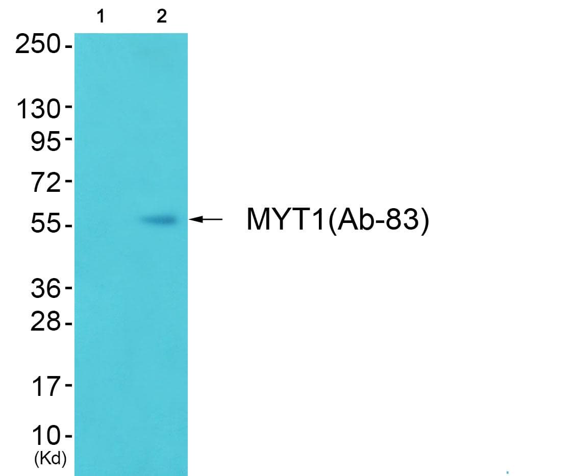 PKMYT1 Antibody (p83)