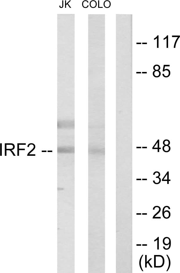IRF2 Antibody (aa101-150)