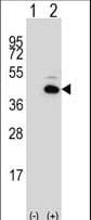 Polyclonal Rabbit anti-Human PITX1 Antibody (aa123-150, WB)