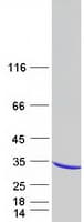 Human RAB30 Protein (Recombinant Myc-DDK (Flag))
