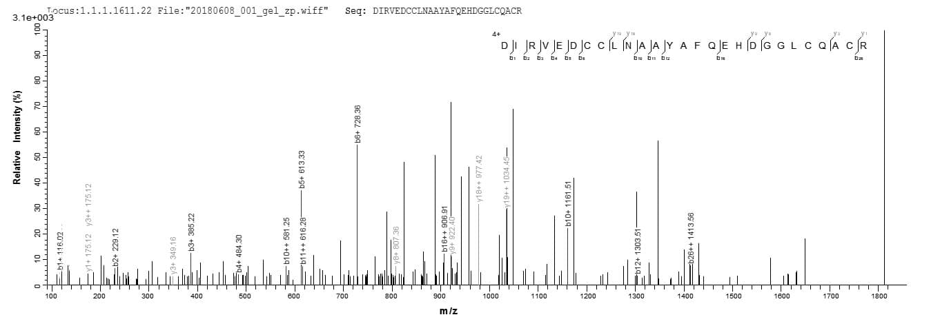 Mouse Properdin / CFP Protein (Recombinant 6His-Myc, C-terminus)
