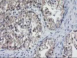 DSTN / Destrin Antibody (clone OTI1C5, Carrier-free)