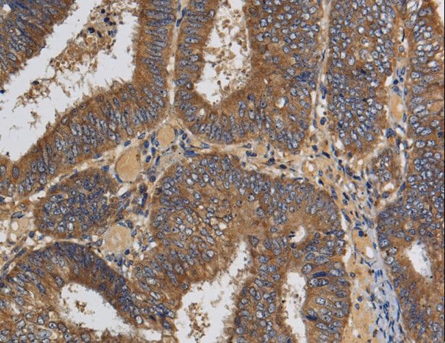 Polyclonal Rabbit anti-Human KLK6 / Kallikrein 6 Antibody (IHC, WB)