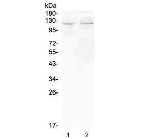 Polyclonal Rabbit anti-Mouse DDR2 Antibody (IHC, WB)