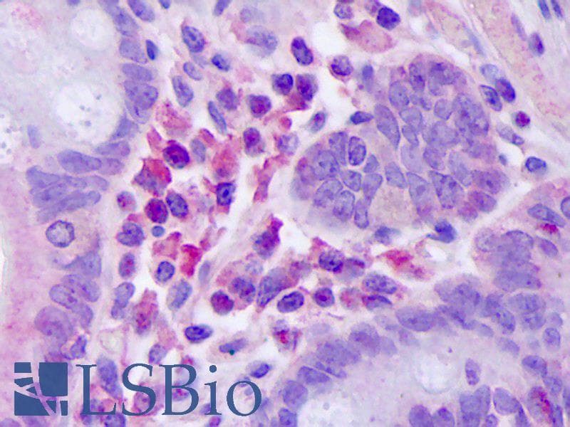 IHC-plus™ Monoclonal Mouse anti-Human IL2RA / CD25 Antibody (IHC, WB)
