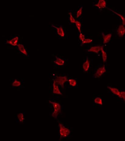 CMTM2 Antibody