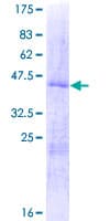 Human RPS14 / Ribosomal Protein S14 (Recombinant GST)
