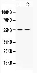 SLC18A3 / VACHT Antibody