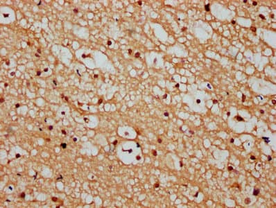 HIST1H3A Antibody